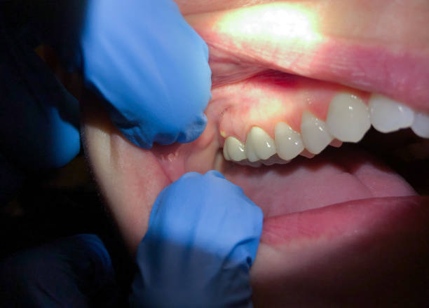 Best Cosmetic Emergency Dentistry in Minco, OK